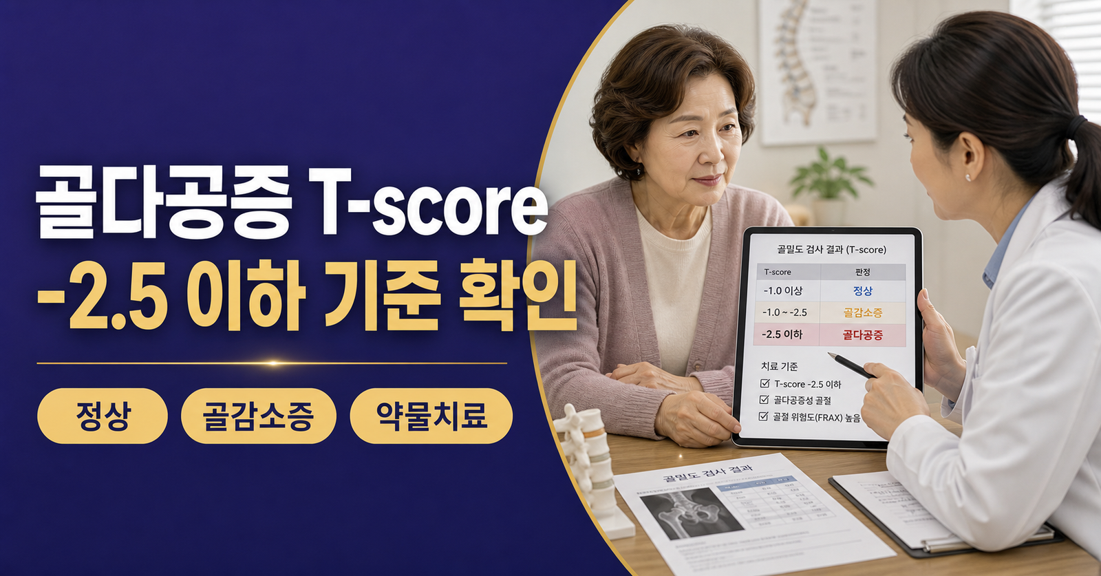 골다공증 검사 결과표 T-score 수치와 약물치료 기준 설명 이미지