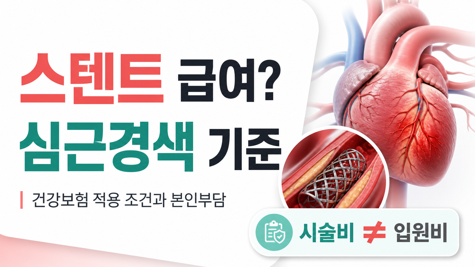 급성심근경색 스텐트 시술 건강보험 급여와 본인부담 기준 썸네일
