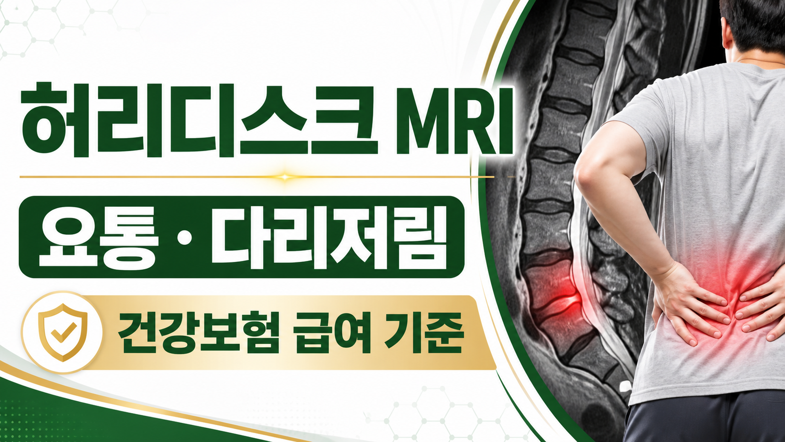 허리디스크 MRI 비용, 요통·다리저림 건강보험 급여 기준 핵심 숫자와 조건을 정리한 썸네일