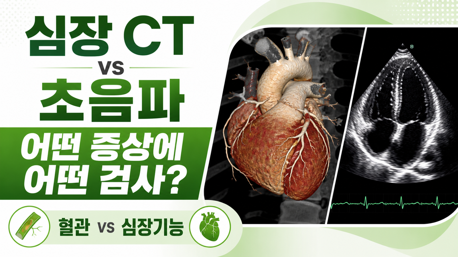 심장 CT와 심장초음파 차이, 어떤 증상에 어떤 검사를 할까 핵심 기준과 확인 절차 썸네일