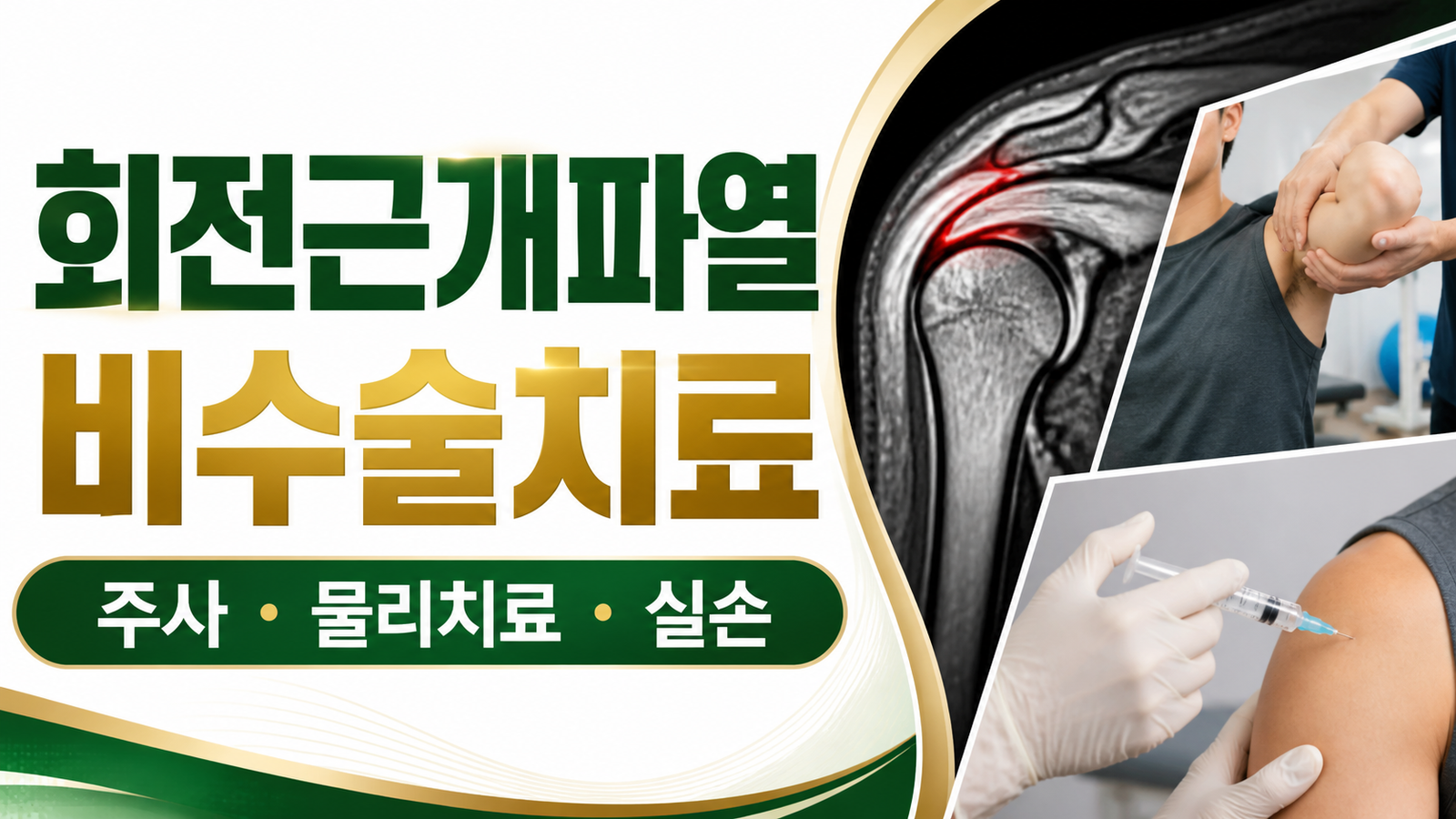 회전근개파열 비수술치료, 주사·물리치료 급여와 실손 청구 핵심 기준과 확인 절차 썸네일