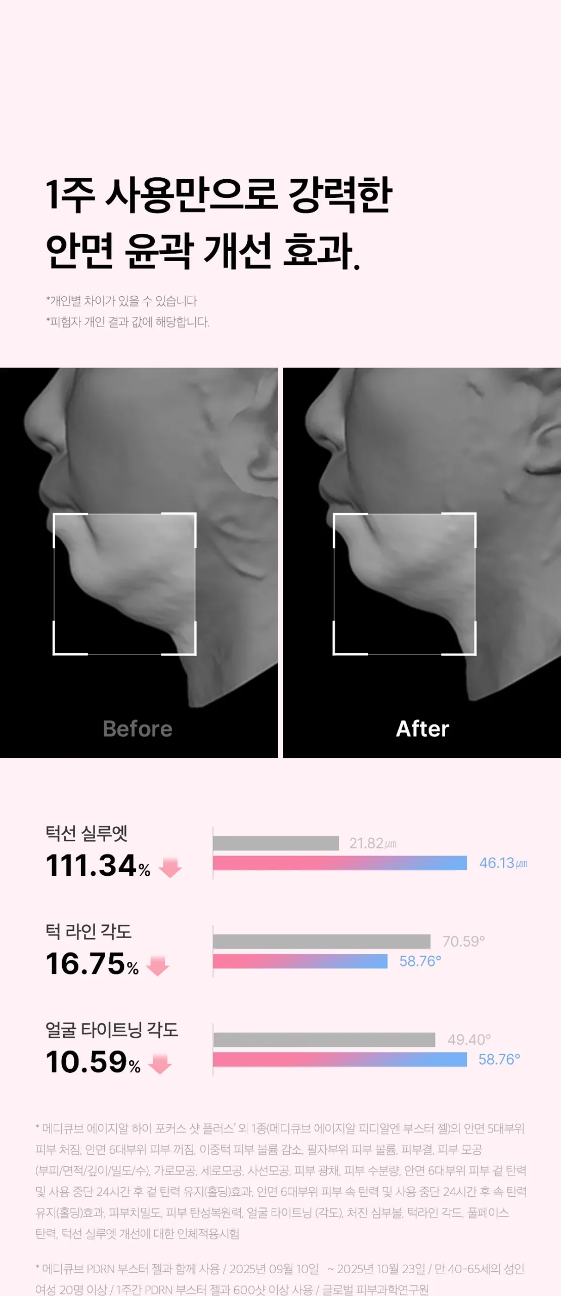 본문 이미지 2